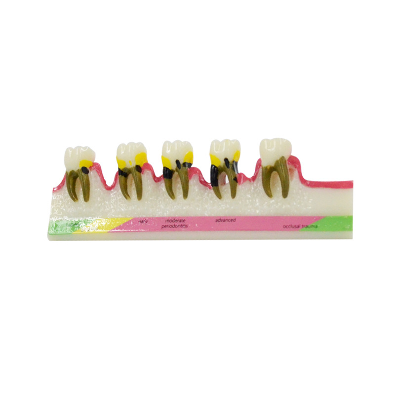 Model chorób periodontologiczn – Medical Lab Study recenzja i cena
