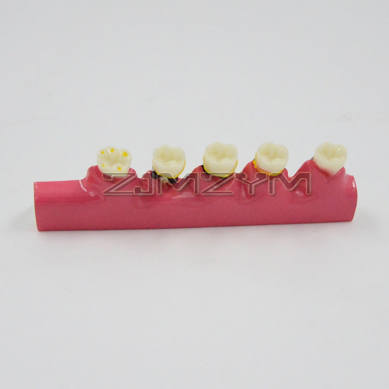 Model chorób periodontologiczn – Medical Lab Study recenzja i cena