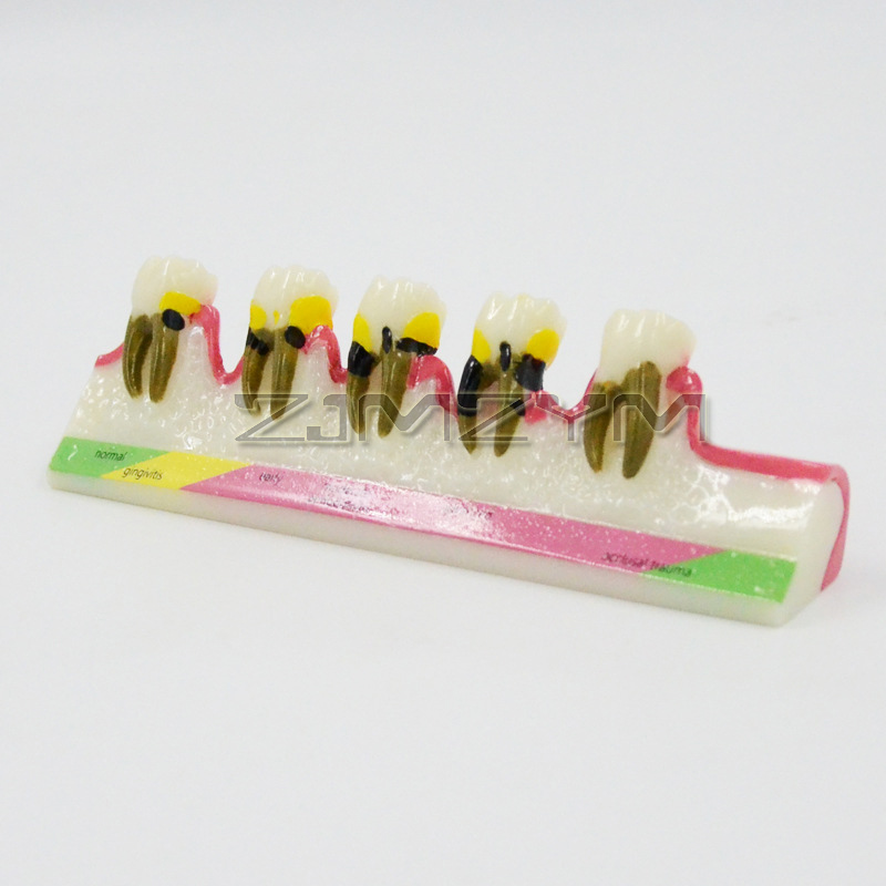 Model chorób periodontologiczn – Medical Lab Study recenzja i cena