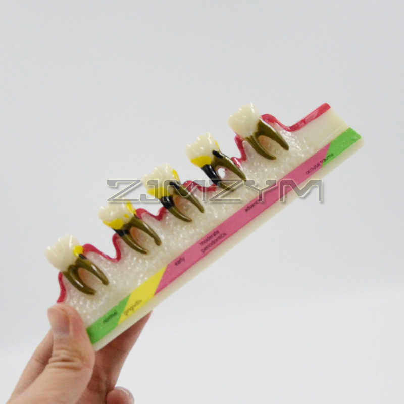 Model chorób periodontologiczn – Medical Lab Study recenzja i cena